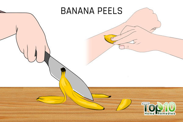 banana peels to treat flat warts