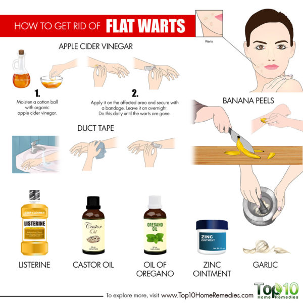 treat flat warts