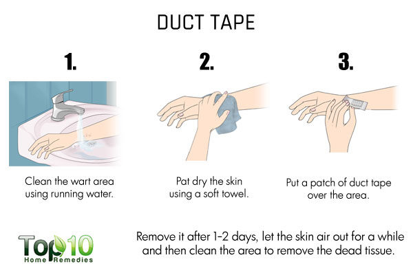 duct tape to treat flat warts