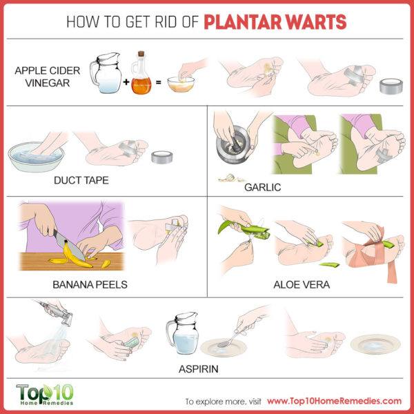 how to get rid of plantar warts