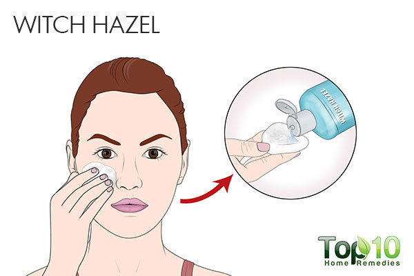 witch hazel for facial broken capillaries 