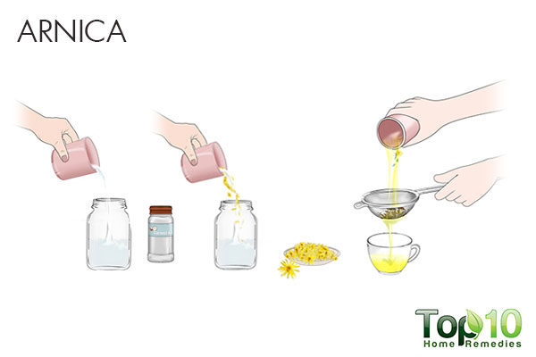 arnica remedy to treat broken capillaries on face