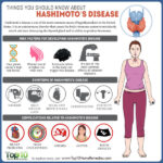 Things You Should Know about Hashimoto’s Disease