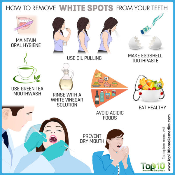 how to remove white spots on teeth